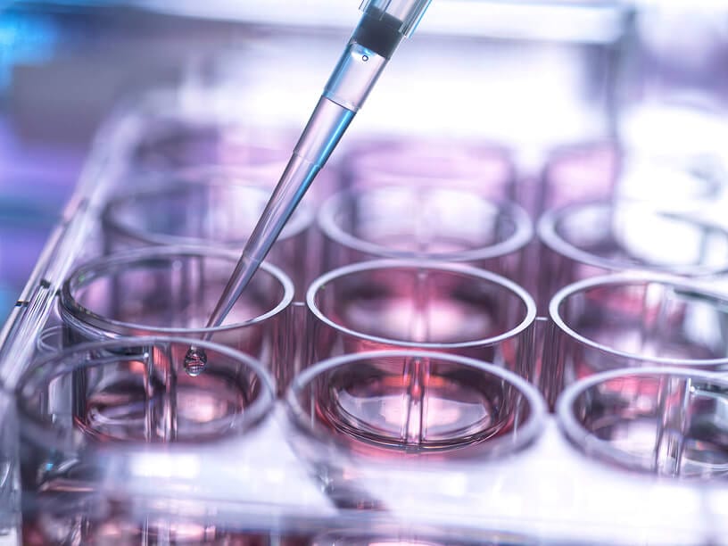 Pipette dosiert Proben in Laborgefäße